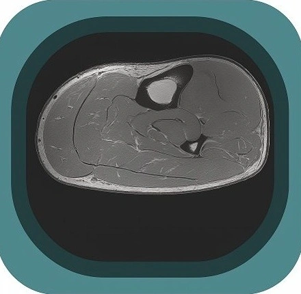 MRI forearm anatomy icon